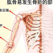 健康科普丨湿滑路面“杀手”，小心肱骨近端骨折