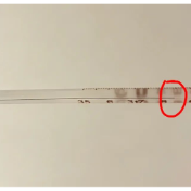 重度湿疹久治难愈，株洲市人民医院中医科精准调理一周顺利康复