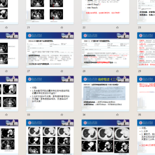 8年三闯鬼门关 湖南省人民医院助晚期肺癌患者重获新生