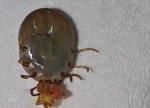 护士发现患者耳后藏蜱虫！ 医生提醒：高温湿热季节需警惕