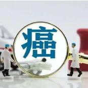 这4种癌症早期筛查真的有用 一文读懂何时查、如何查
