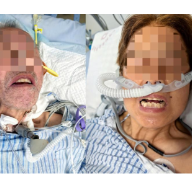 从苦笑面容到微笑从容，南华医院成功救治多例危重症破伤风患者