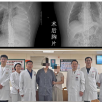 18岁少年胸腔藏3.89公斤“巨弹”,中南大学湘雅医院多学科联手精准拆除