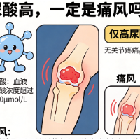 尿酸高,一定是痛风吗?