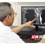 “韧带变成硬骨头” 宜章首例ACAF手术解难题
