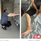 医疗服务提升年丨十年髋痛难自由 永州市中心医院DAA前路微创髋关节置换术助老人重拾自如生活