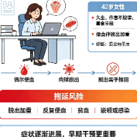 健康科普 | 痔疮不是难言之隐：早查早治，守住肛周健康