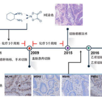 从1例患者到守护家族百人健康，吴畏团队解码遗传性结直肠肿瘤