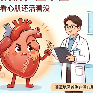 血管堵了要不要搭桥?湘潭首例心脏“验活”技术精准判“生死”