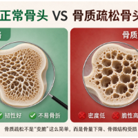 世界骨质疏松日丨骨质疏松，到底能不能“治好”？