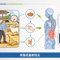 “腰突”治了5个月不见好，竟是羊圈里的布鲁氏菌作祟